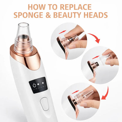 Handled Pore Vacuum Cleaner - Clear Your Pores in 5 Minutes No Squeezing Needed